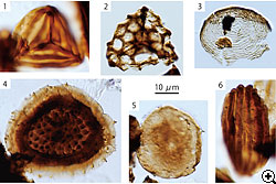 花粉・胞子化石の顕微鏡写真